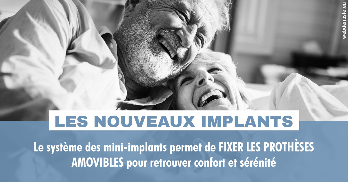 https://dr-dossou-olga.chirurgiens-dentistes.fr/Les nouveaux implants 2