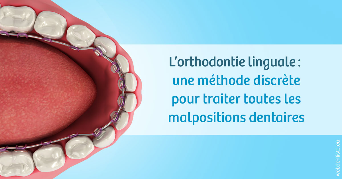 https://dr-dossou-olga.chirurgiens-dentistes.fr/L'orthodontie linguale 1