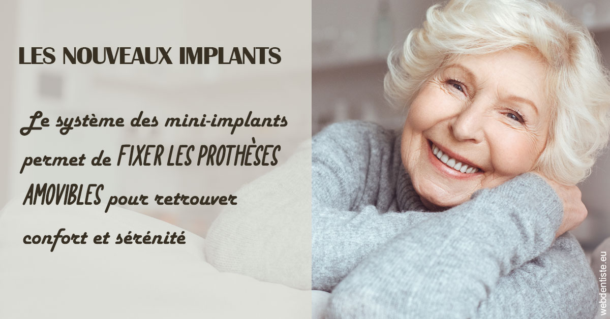 https://dr-dossou-olga.chirurgiens-dentistes.fr/Les nouveaux implants 1