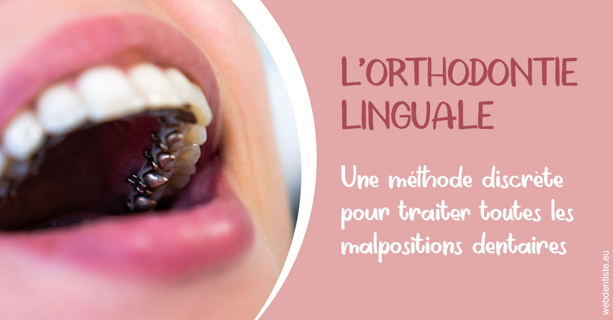 https://dr-dossou-olga.chirurgiens-dentistes.fr/L'orthodontie linguale 2