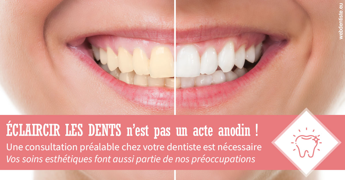 https://dr-dossou-olga.chirurgiens-dentistes.fr/Eclaircir les dents 1