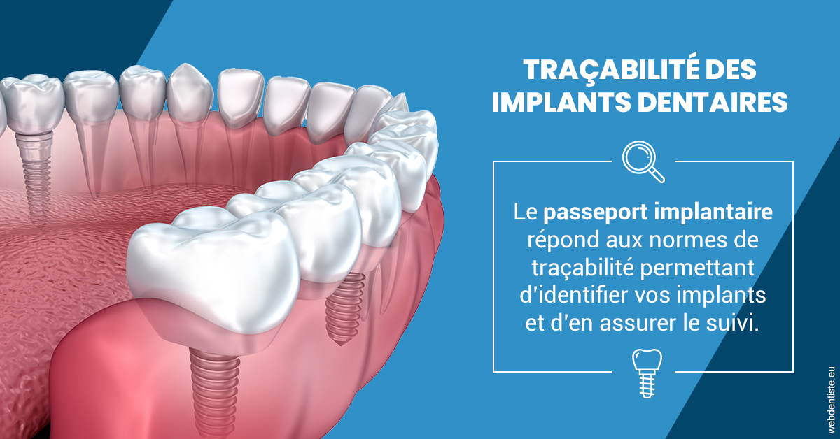 https://dr-dossou-olga.chirurgiens-dentistes.fr/T2 2023 - Traçabilité des implants 1