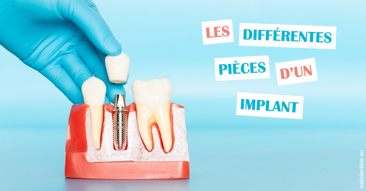 https://dr-dossou-olga.chirurgiens-dentistes.fr/Les différentes pièces d’un implant 2