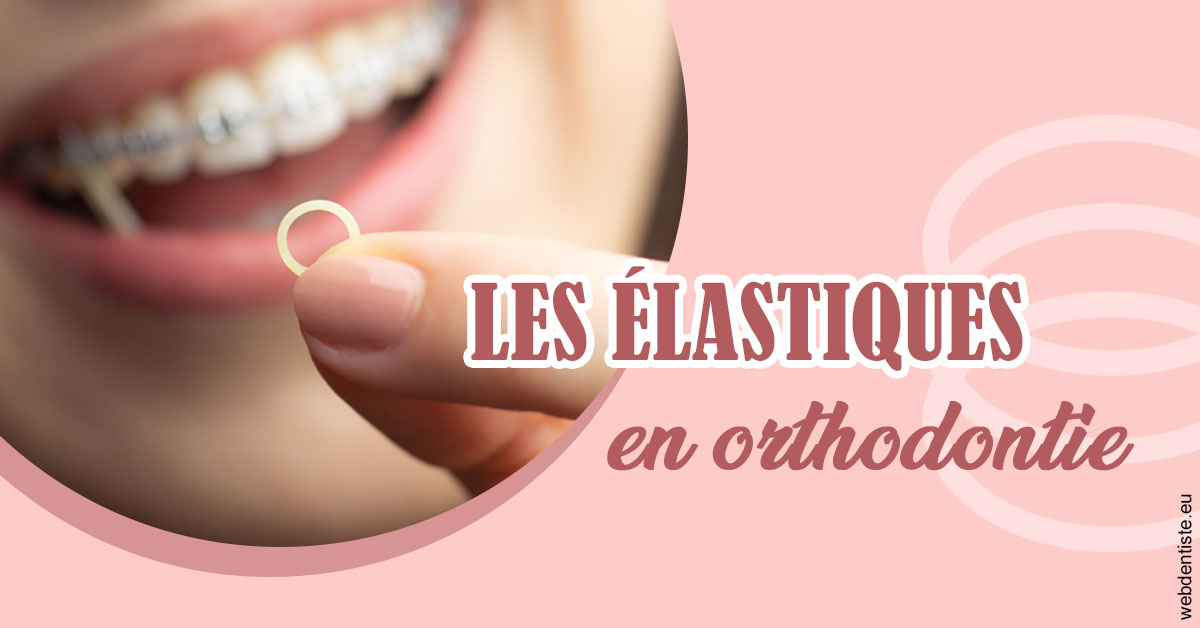 https://dr-dossou-olga.chirurgiens-dentistes.fr/Elastiques orthodontie 1