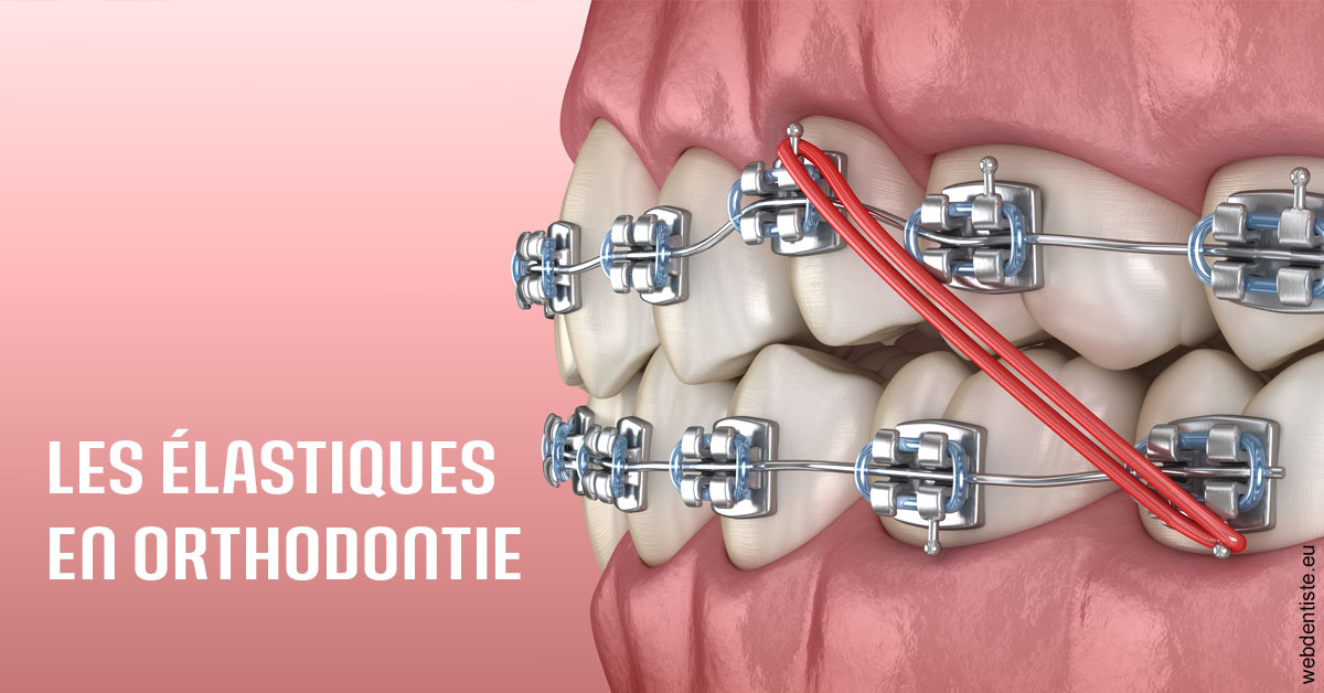 https://dr-dossou-olga.chirurgiens-dentistes.fr/Elastiques orthodontie 2