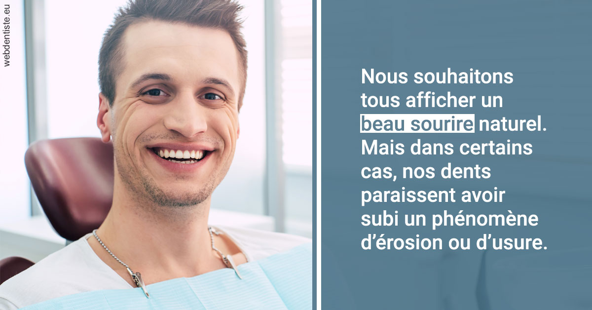 https://dr-dossou-olga.chirurgiens-dentistes.fr/Érosion et usure dentaire