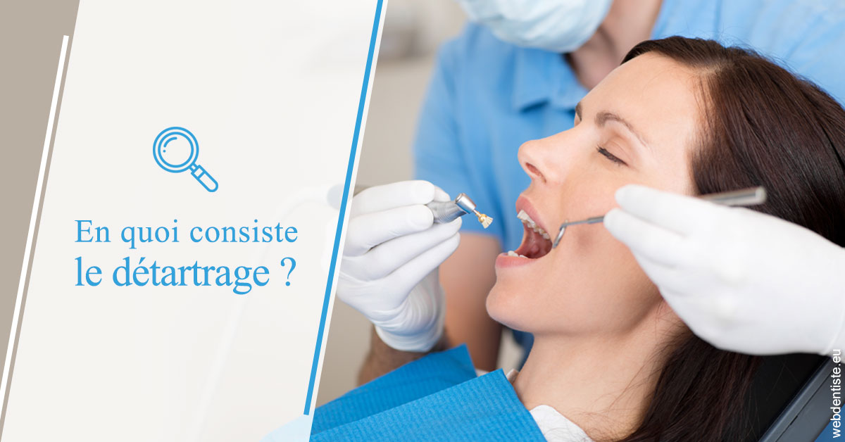 https://dr-dossou-olga.chirurgiens-dentistes.fr/En quoi consiste le détartrage