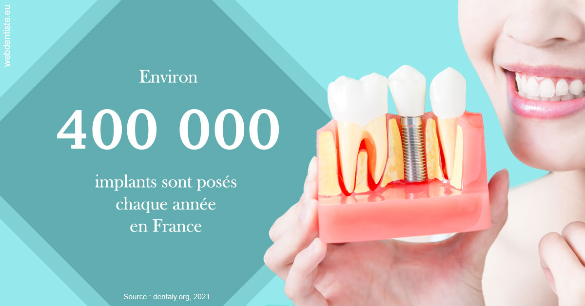https://dr-dossou-olga.chirurgiens-dentistes.fr/Pose d'implants en France 2