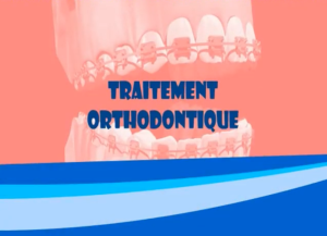 Buts du ulaitement orthodontique